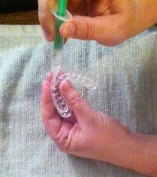 DIY Teeth Whitening: Smile Brilliant Review DIY Teeth Whitening: Smile Brilliant Review
