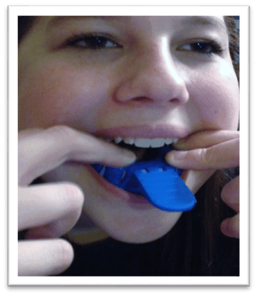 DIY Teeth Whitening: Smile Brilliant Review DIY Teeth Whitening: Smile Brilliant Review
