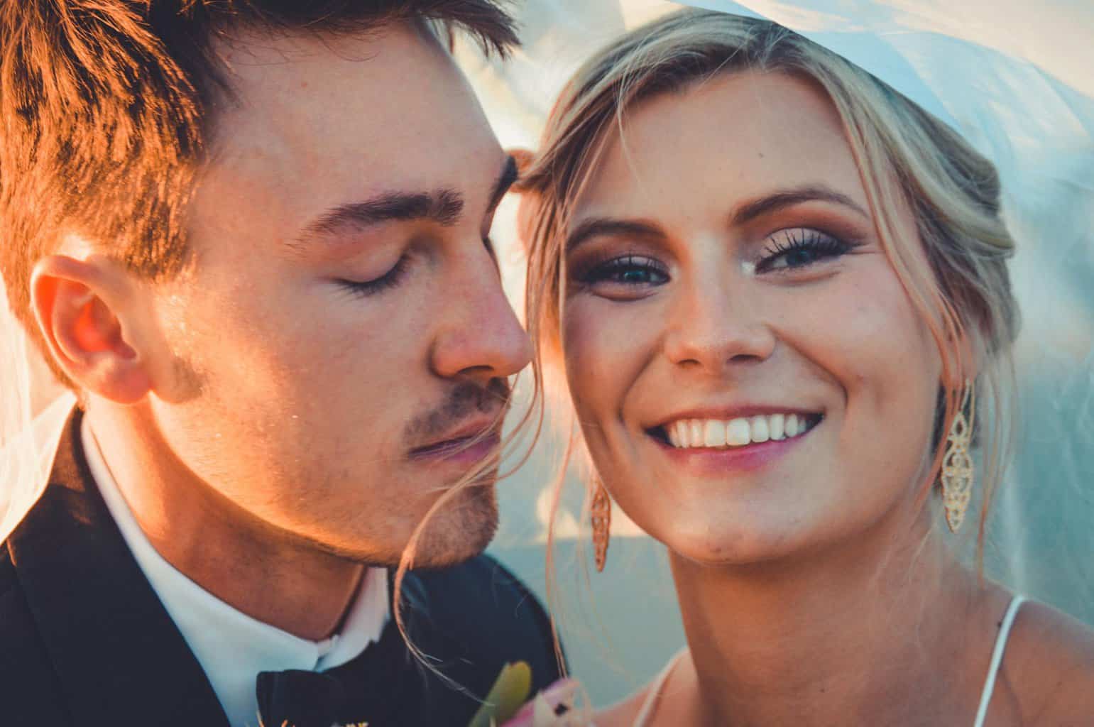 How to Get a Wedding-Ready Smile